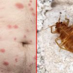 4 Penyakit Berbahaya Yang Diakibatkan oleh Gigitan Nyamuk